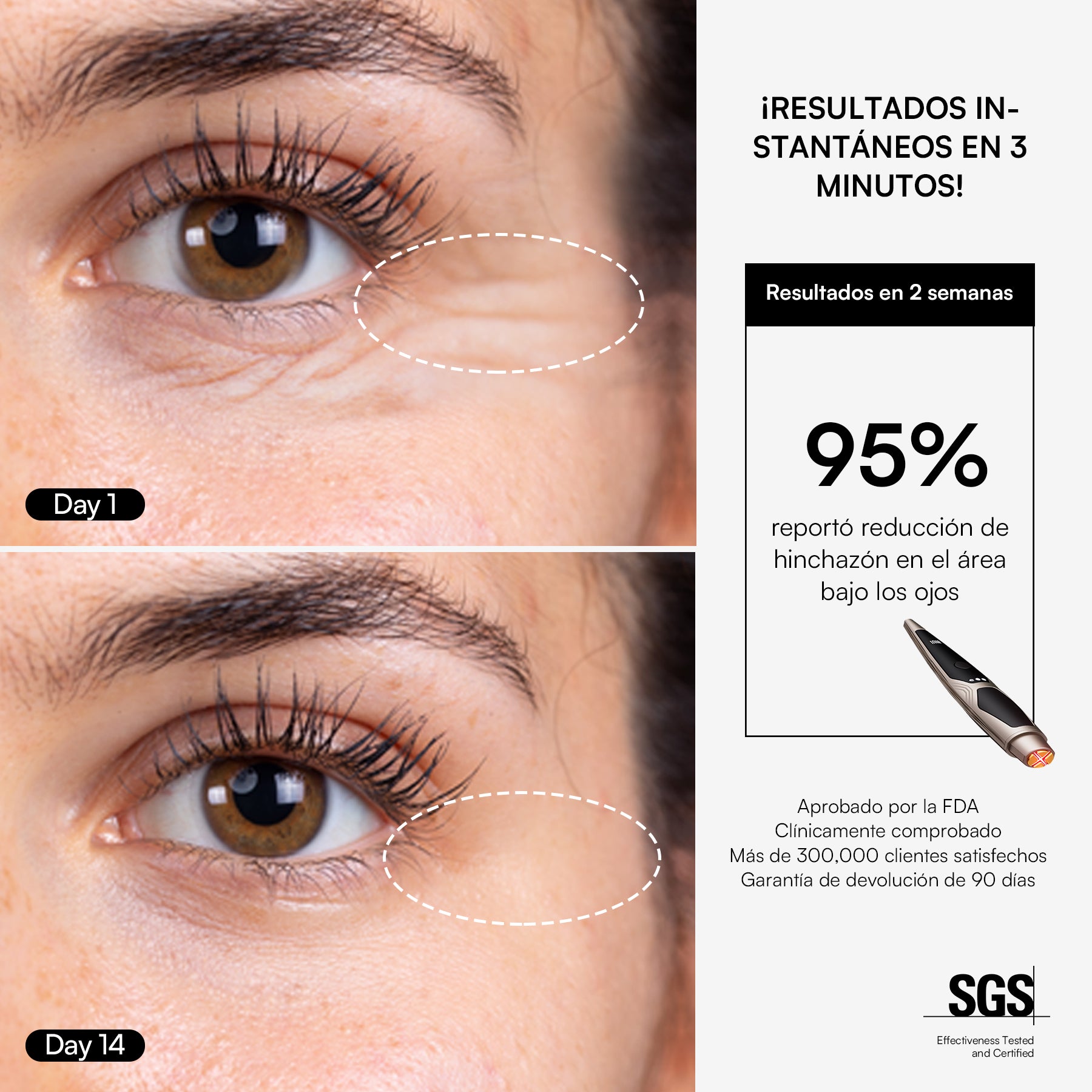 INIA LUMIN eye care device results: reduced wrinkles and puffiness in 2 weeks, FDA-approved.
