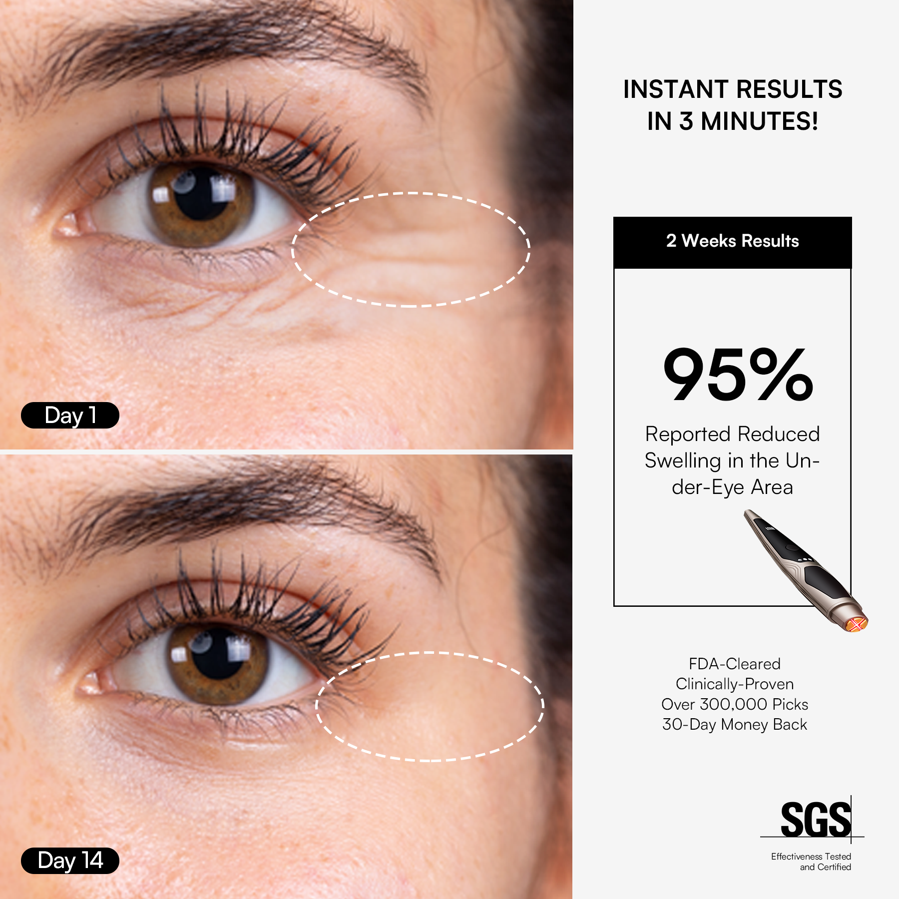 INIA LUMIN eye device: reduced under-eye swelling, clinically proven results. Instant skincare.