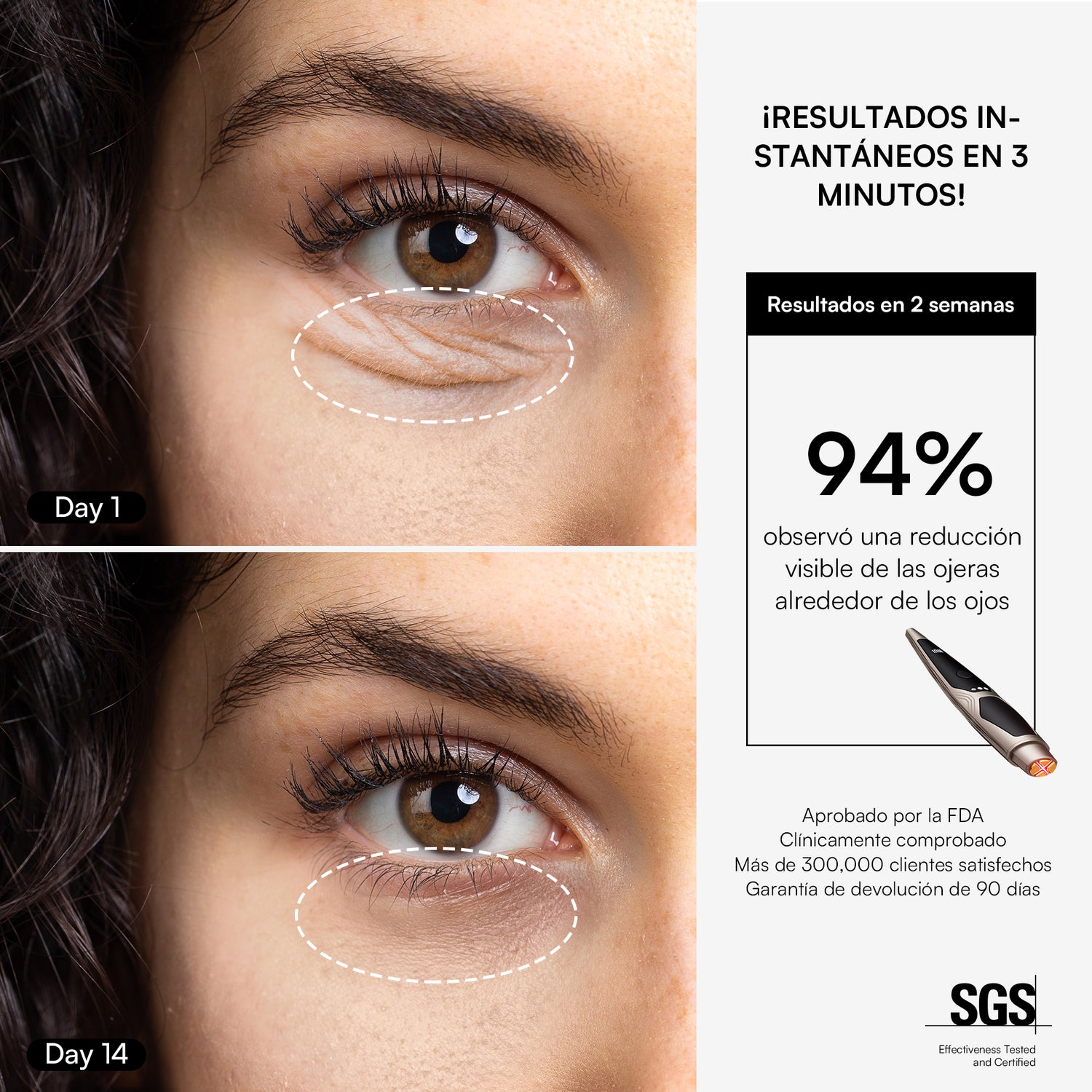 INIA LUMIN eye care device, visible reduction of wrinkles and puffiness in 2 weeks, FDA-approved