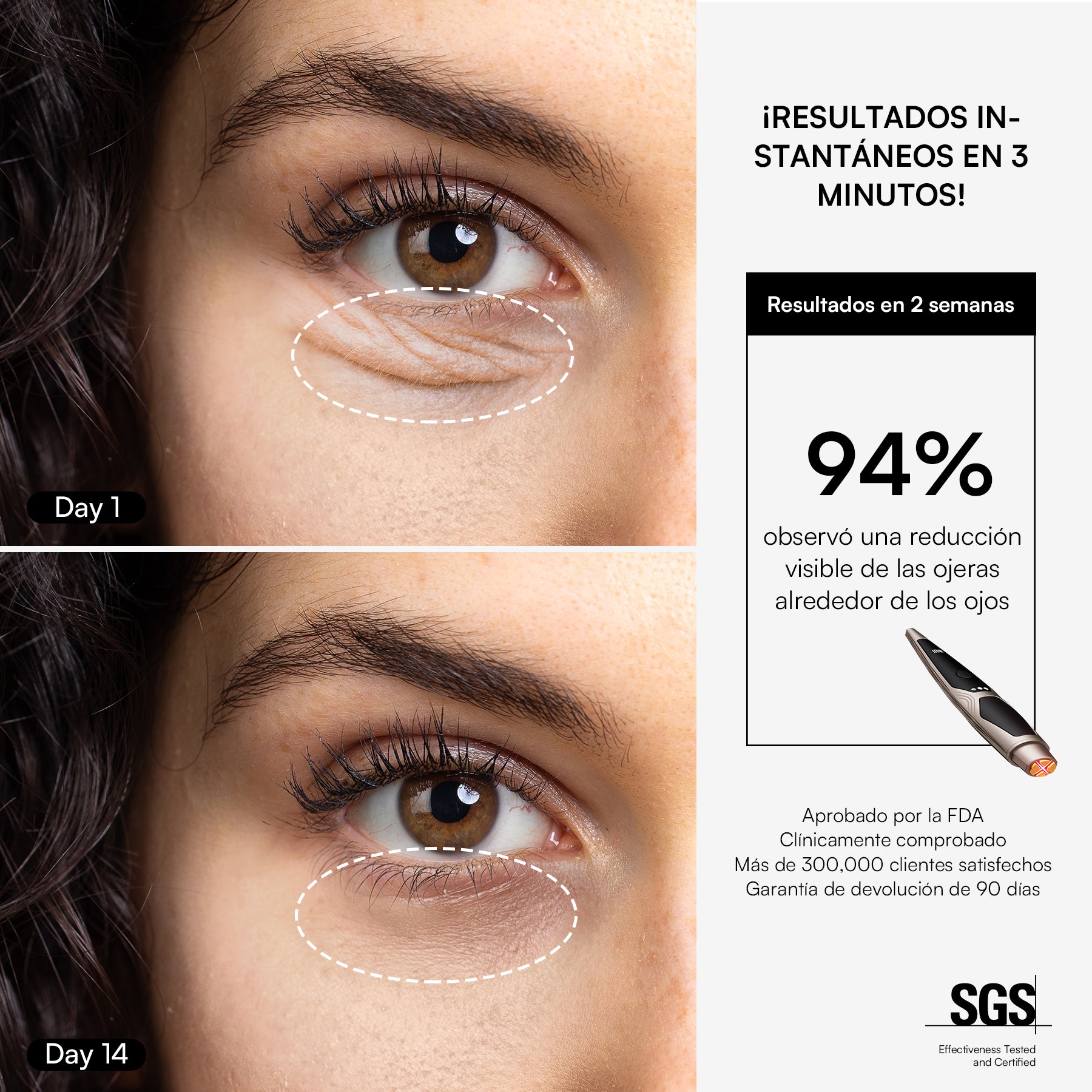 INIA LUMIN eye care device, visible reduction of wrinkles and puffiness in 2 weeks, FDA-approved