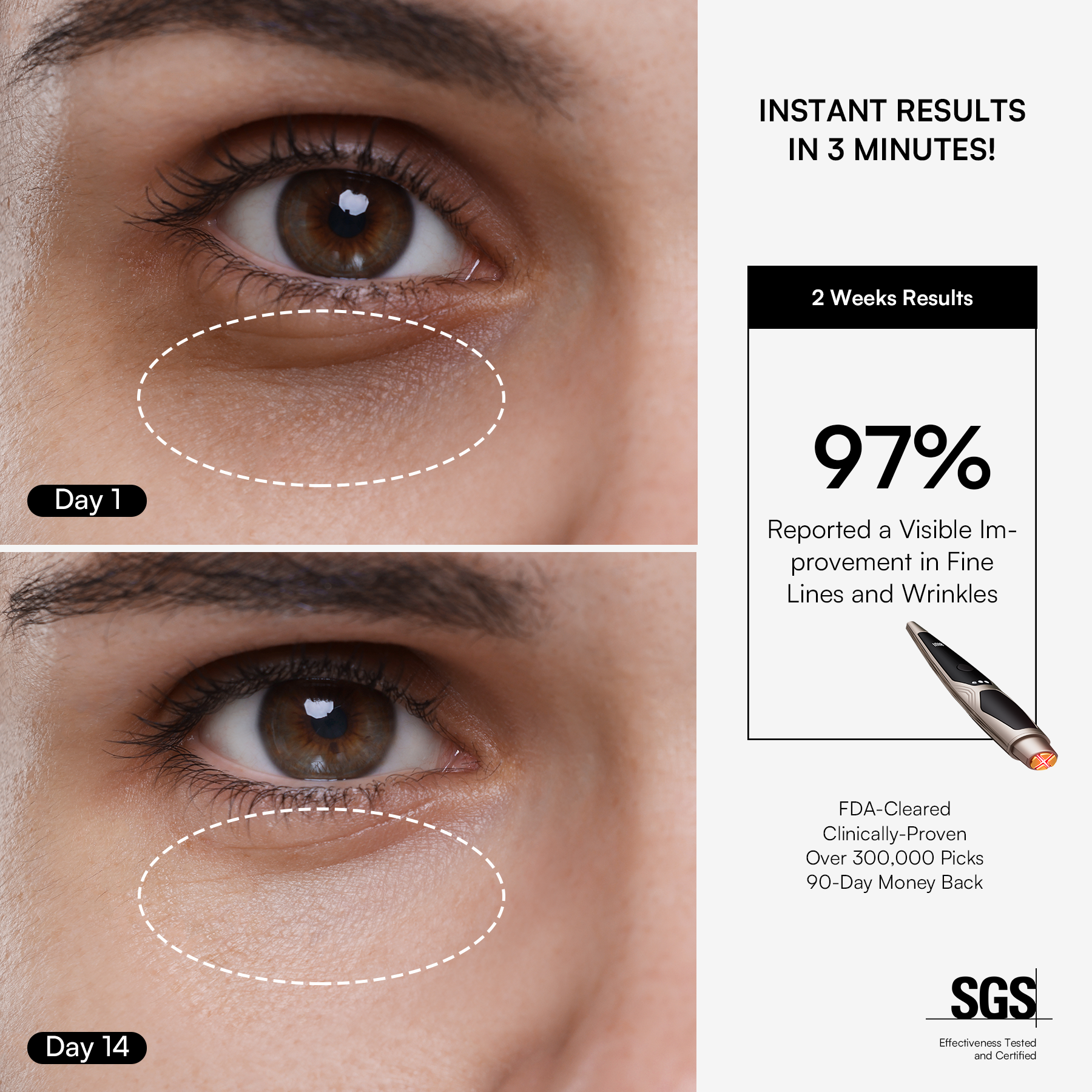 INIA LUMIN eye device: reduces wrinkles around eyes, clinically proven skincare for anti-aging.