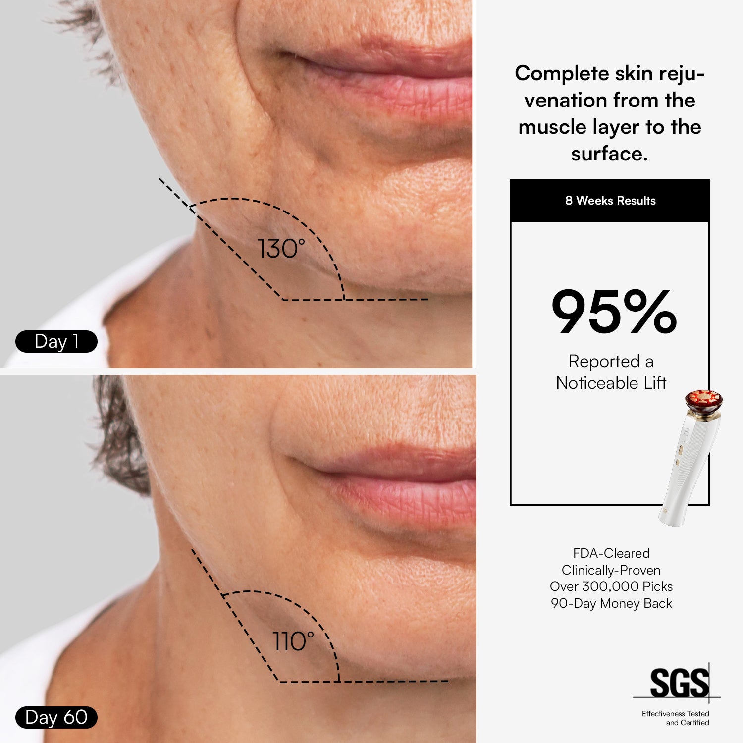 INIA FLARE Microcurrent Facial Device