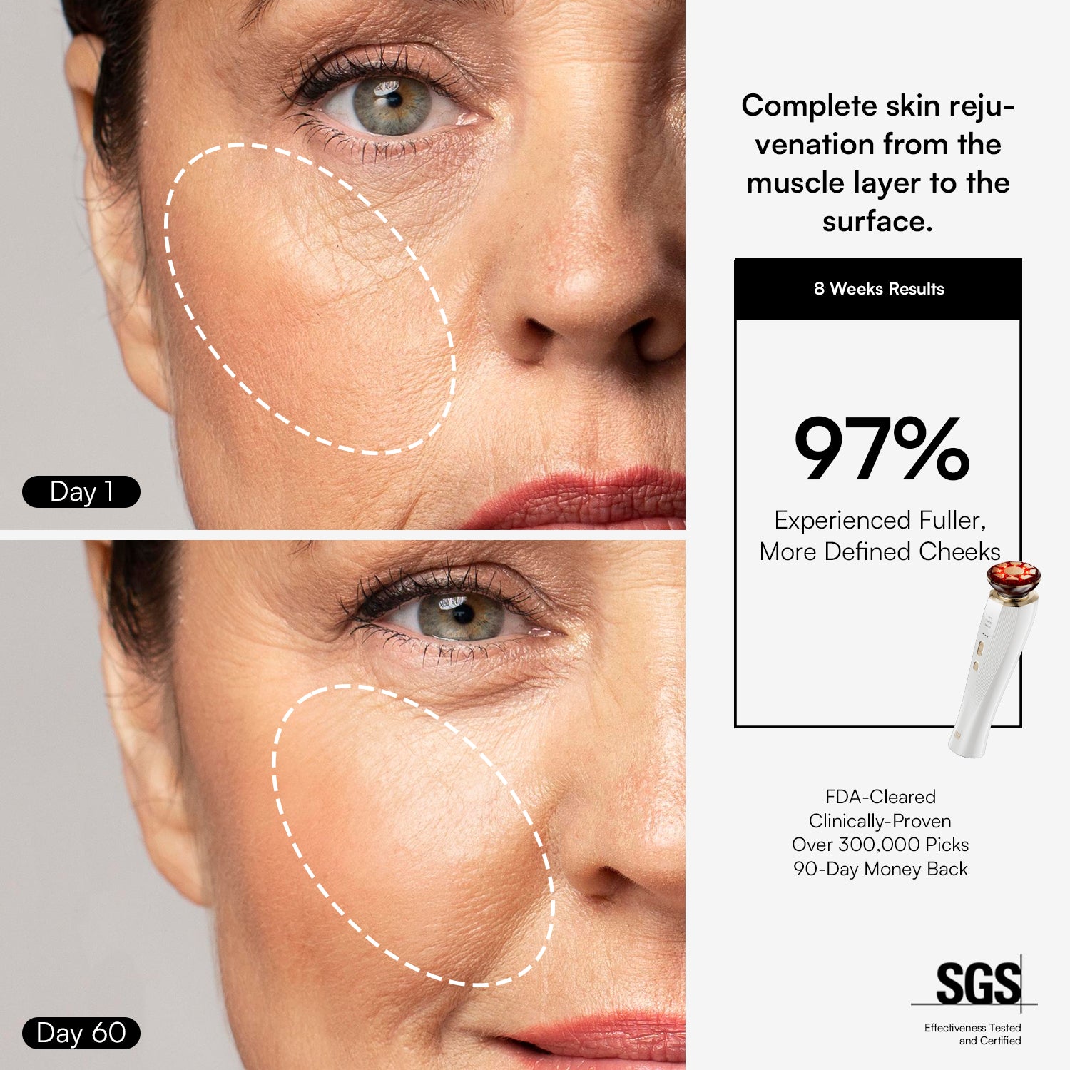 INIA FLARE Microcurrent Facial Device