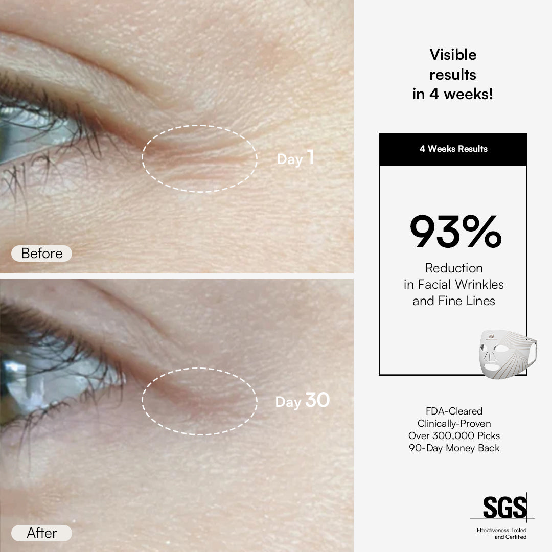 INIA GLOW Red Light Therapy Mask before and after results, 93% reduction in wrinkles in 4 weeks