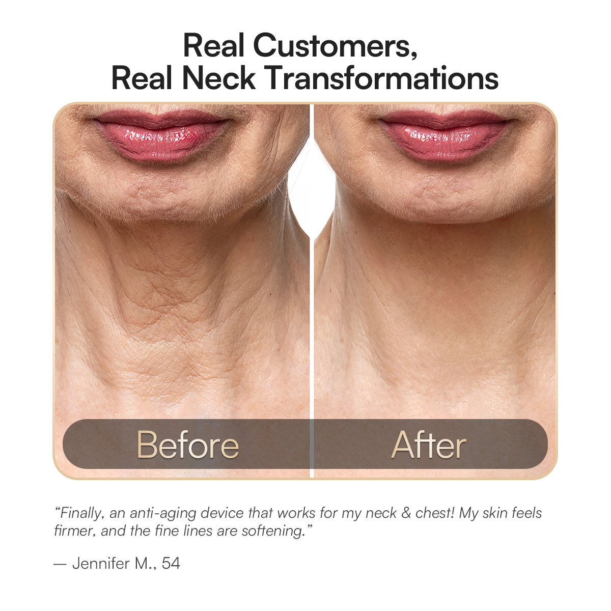 INIA GLOW Neck Red Light Therapy: Before and After Neck Transformation, Smoothing Fine Lines