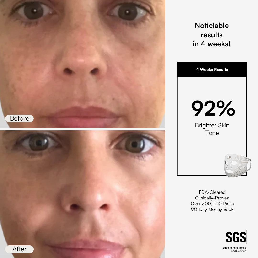 INIA GLOW Red Light Therapy Mask before and after results showing 92% brighter skin tone in 4 weeks