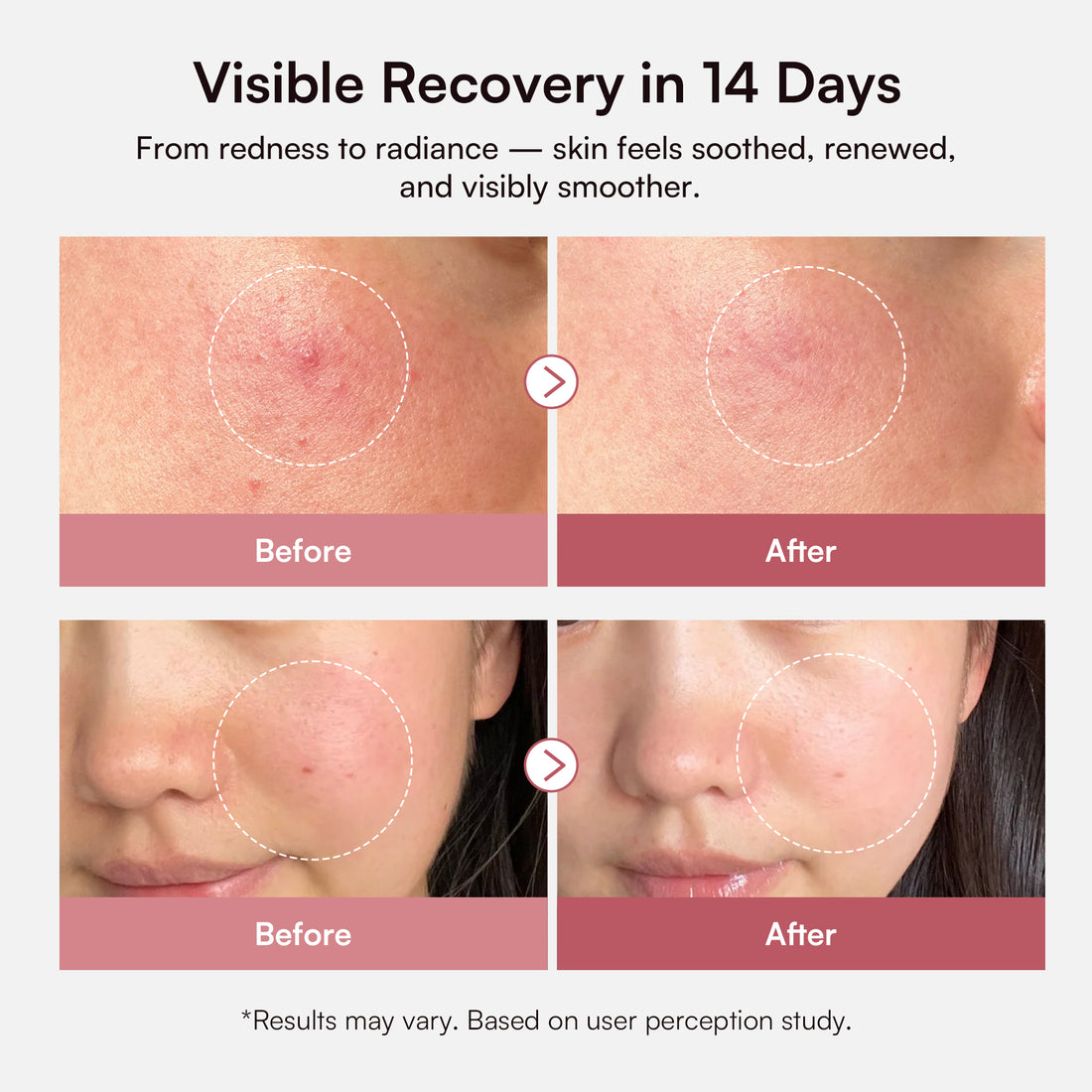 INIA PDRN + Peptide Repair Serum