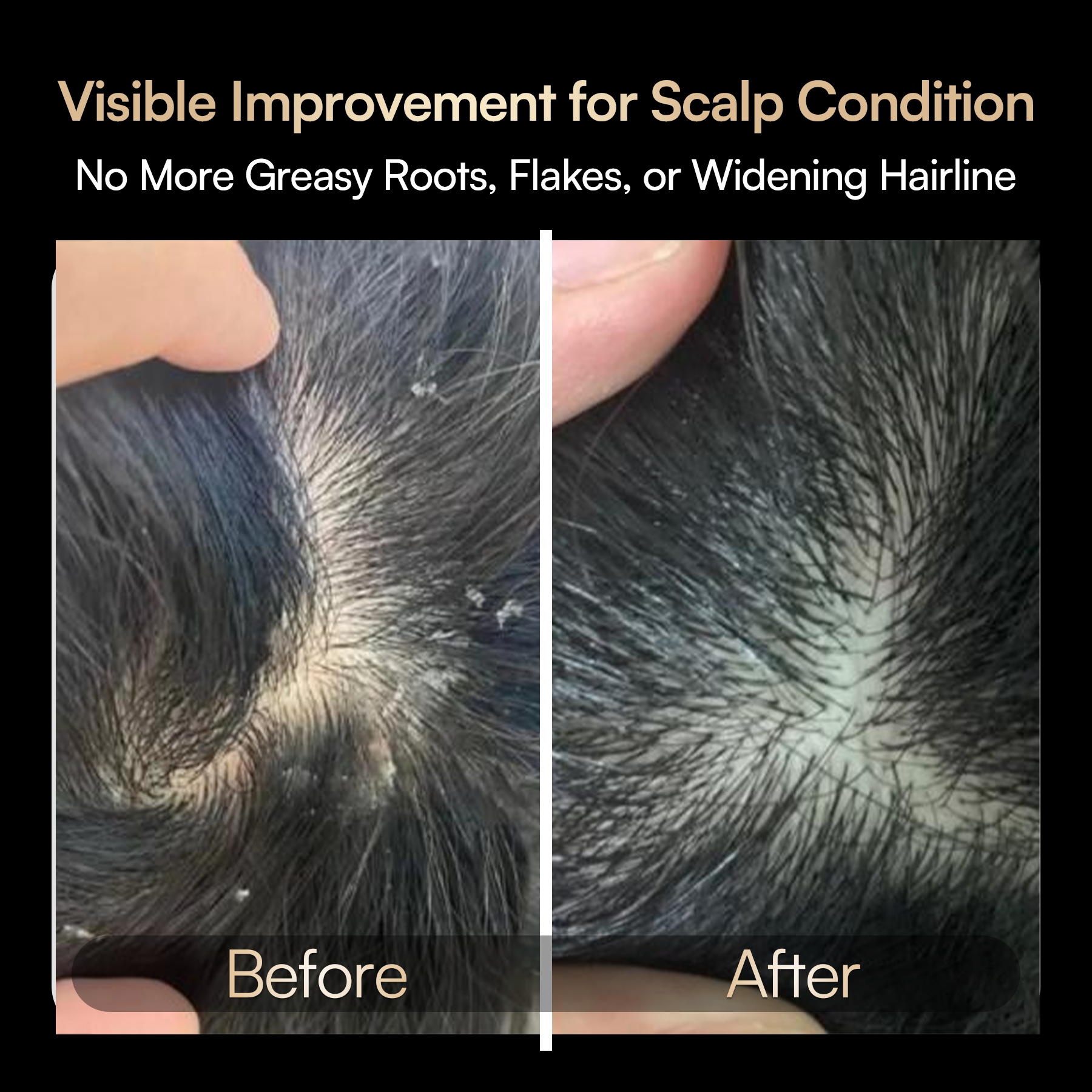 INIA VIBRA device results: &