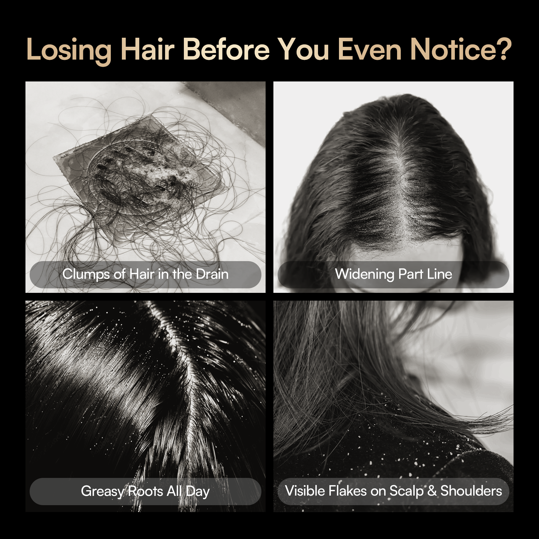Early signs of hair loss: Clumps of hair, widening part, greasy roots, and visible flakes.