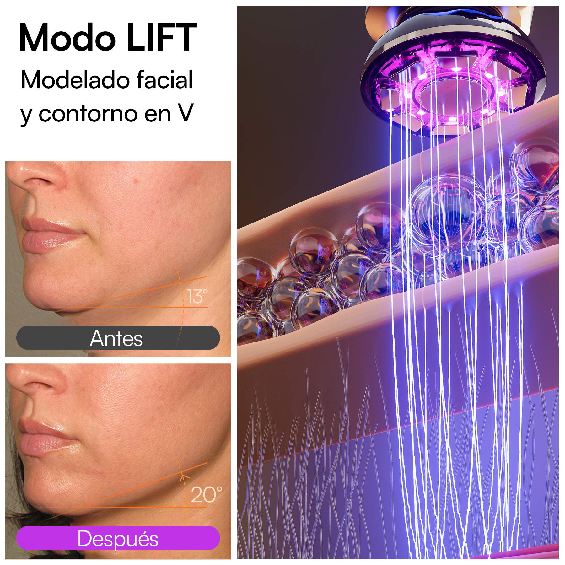 INIA FLARE Dispositivo Facial de Microcorriente