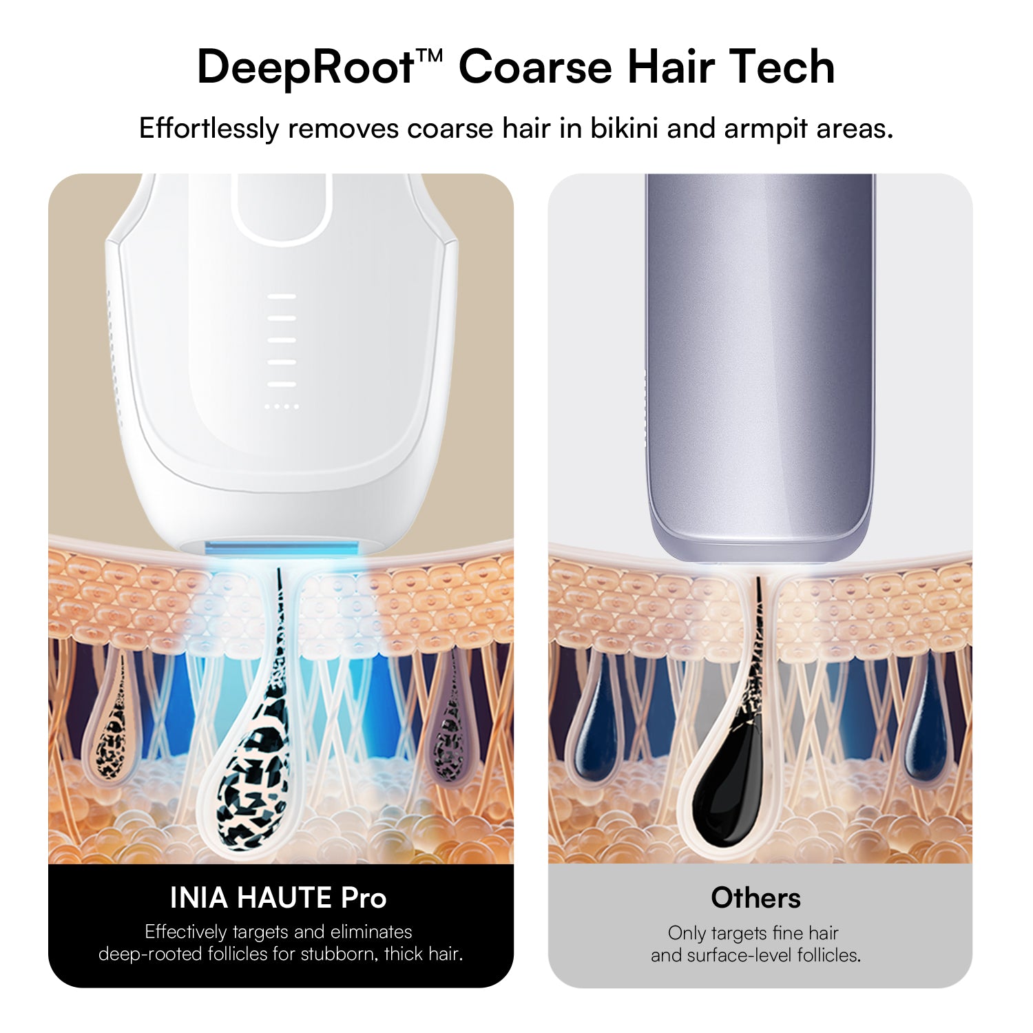 INIA HAUTE Pro: Removes coarse hair and targets deep follicles, for superior red light hair removal.