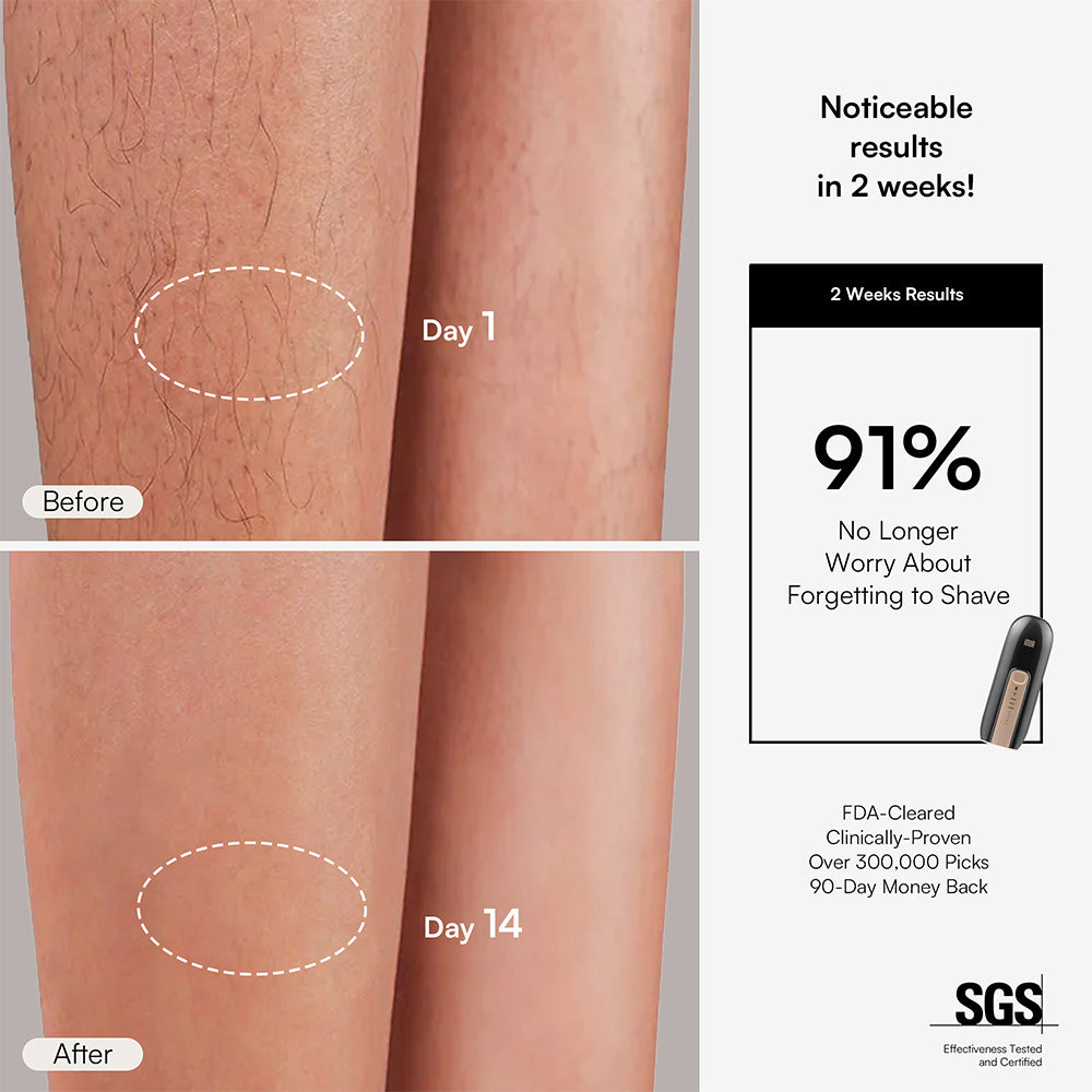 INIA FOND IPL Hair Removal with Facial Mask