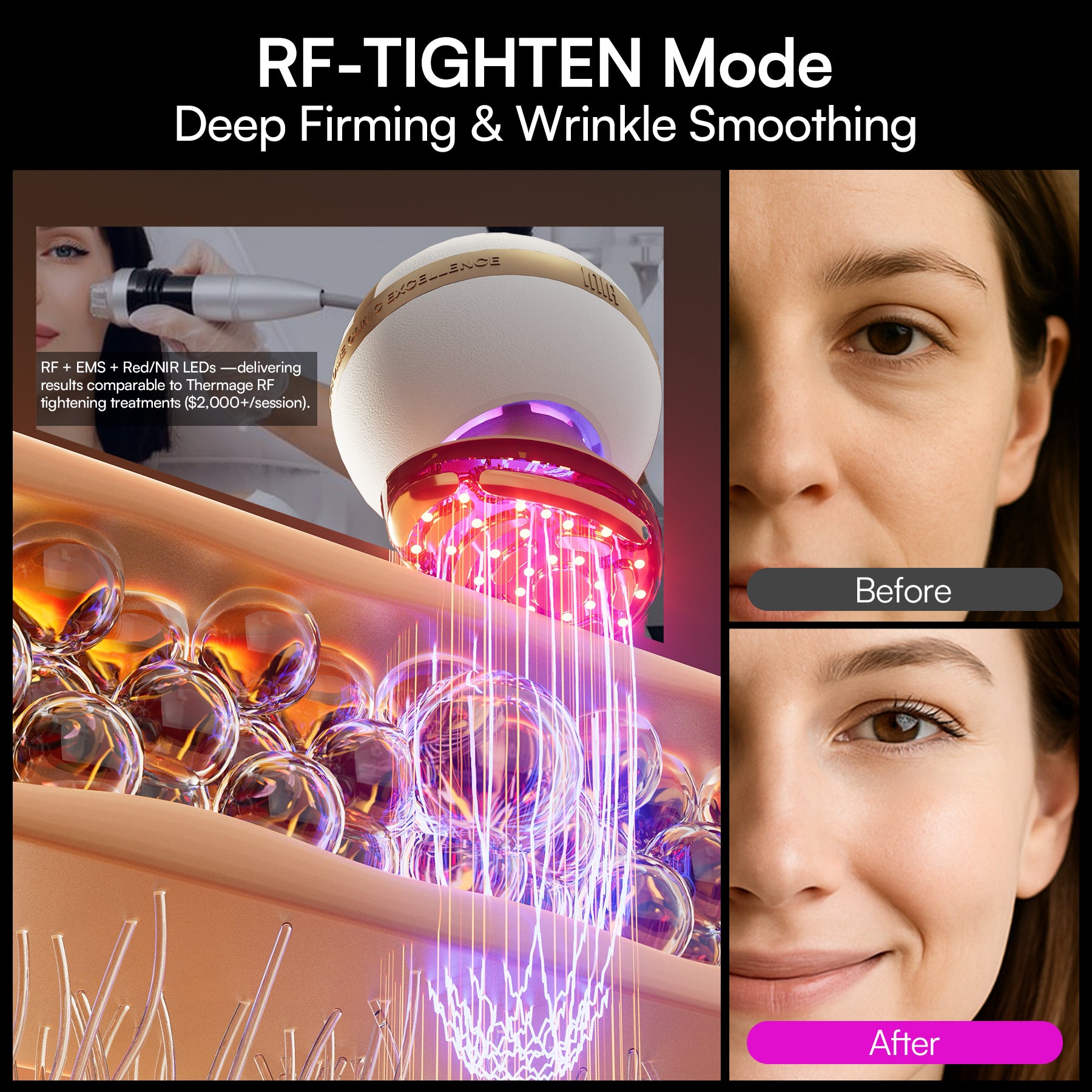 INIA SPHERA At-Home Clinical-Grade RF, EMS & LED Rejuvenation Device