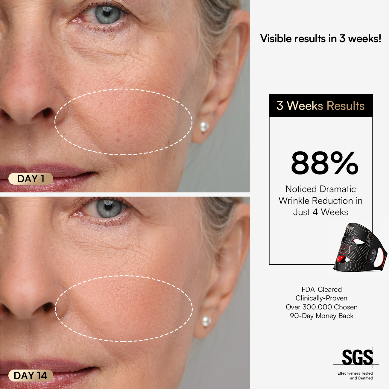 Wireless Red Light Mask: Reduces wrinkles in 4 weeks. Clinically proven results. FDA-cleared INIA GLOW