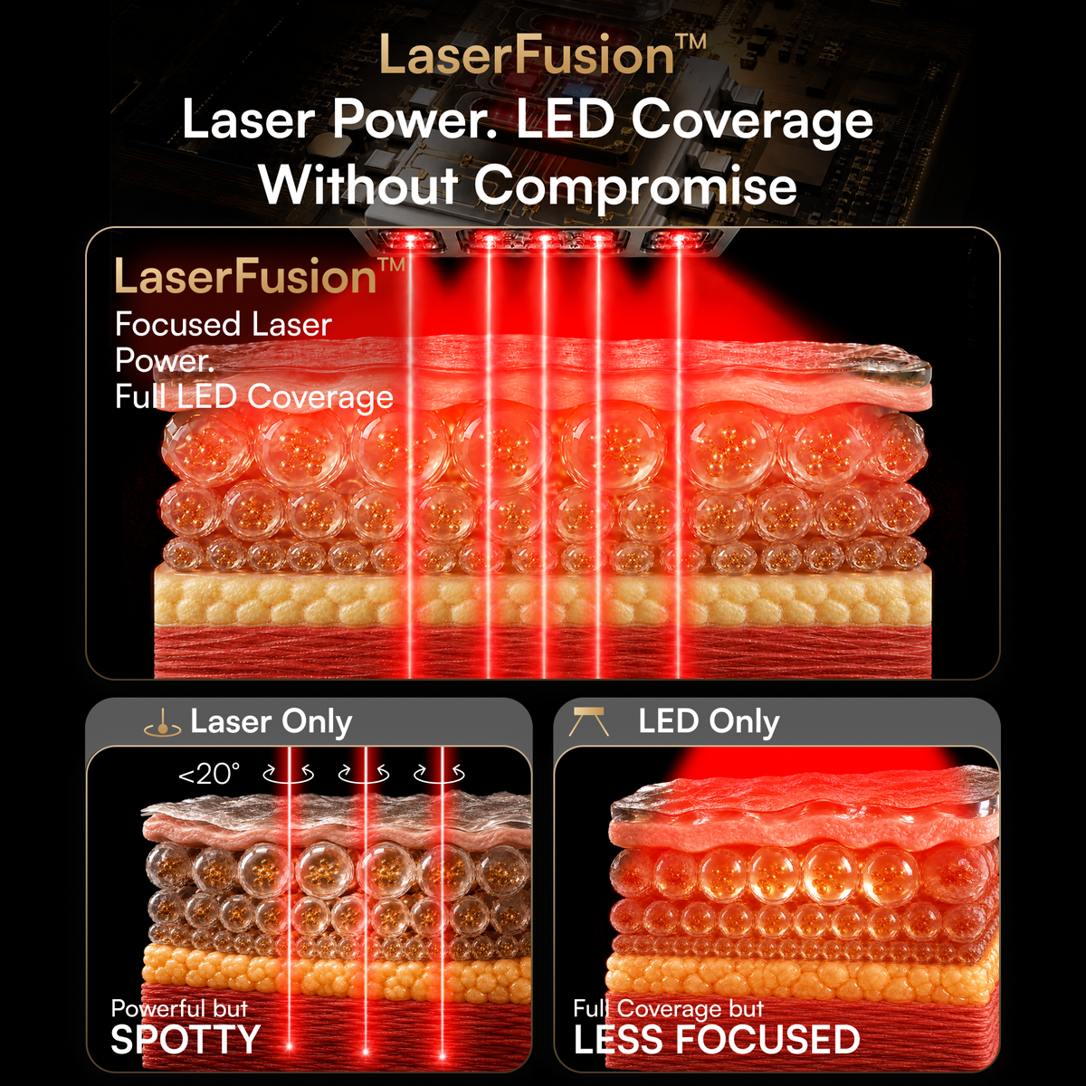 INIA GLOW 4D 1064nm LaserFusion™ Wireless Laser Mask