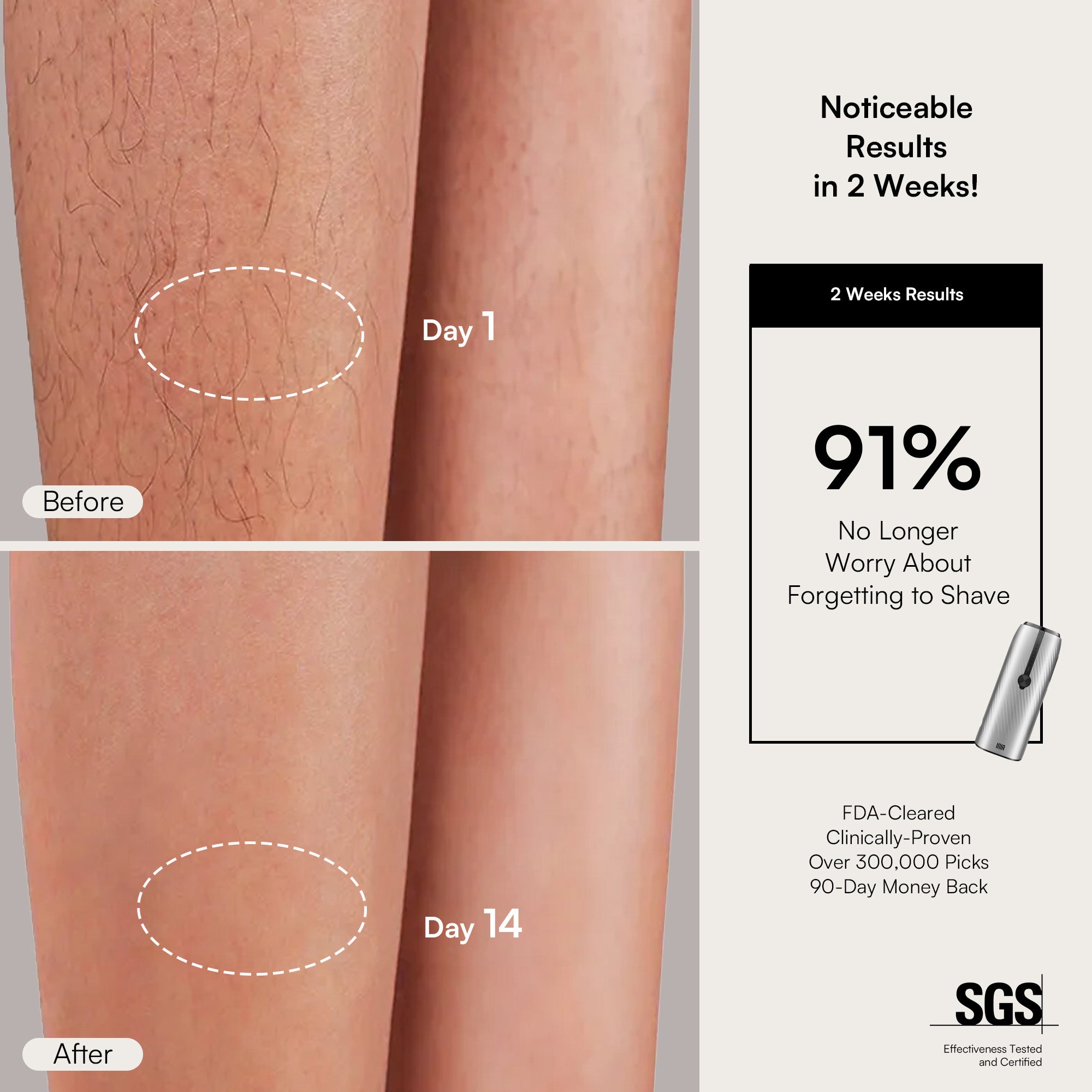 INIA IPL results: Effective red light hair removal. See visible hair reduction in just 2 weeks!