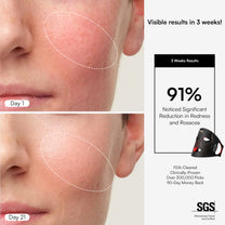Red Light Therapy Mask Anti-Aging Face Treatment INIA