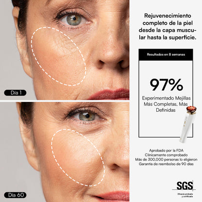 INIA FLARE Dispositivo Facial de Microcorriente