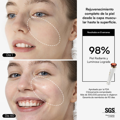 INIA FLARE Dispositivo Facial de Microcorriente