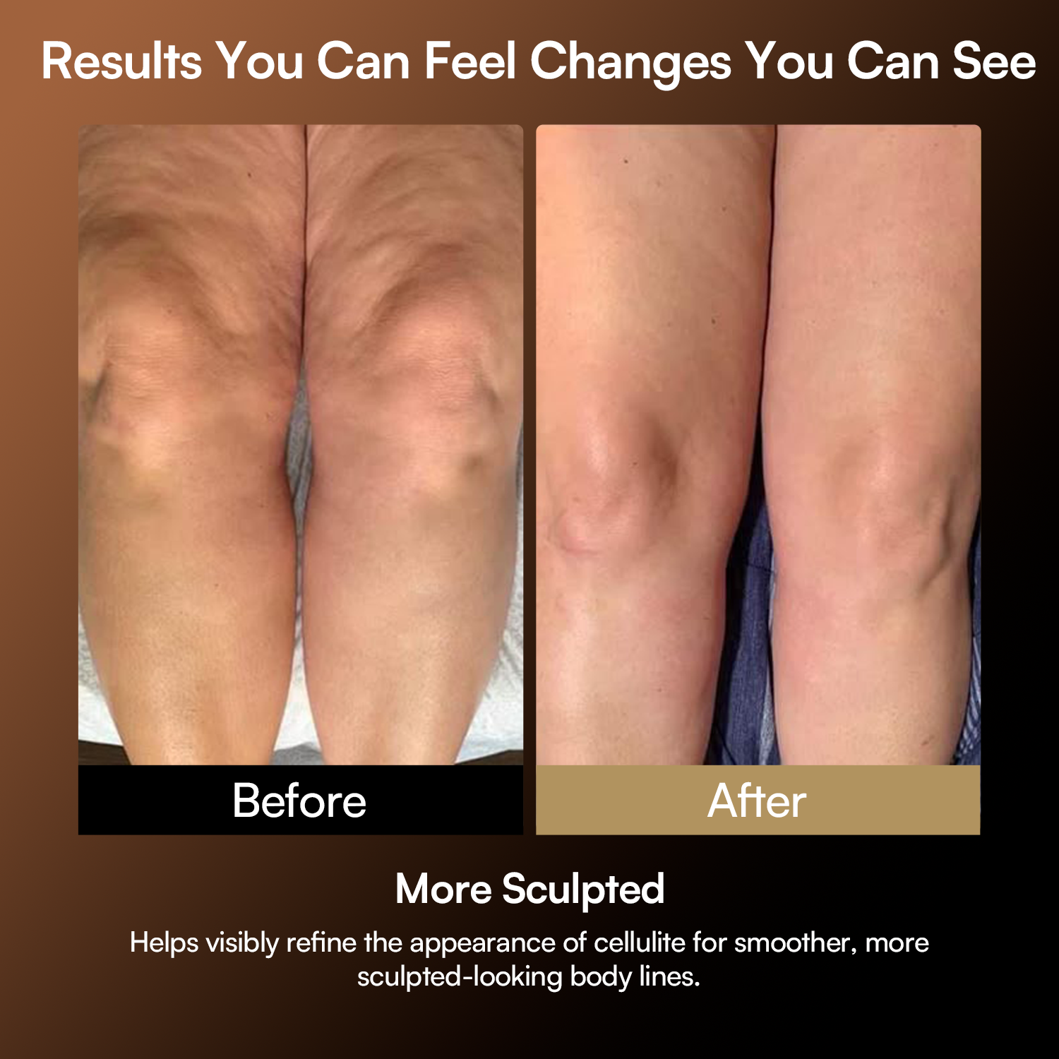 INIA FASCIOR Body Sculpting &amp; Recovery Device