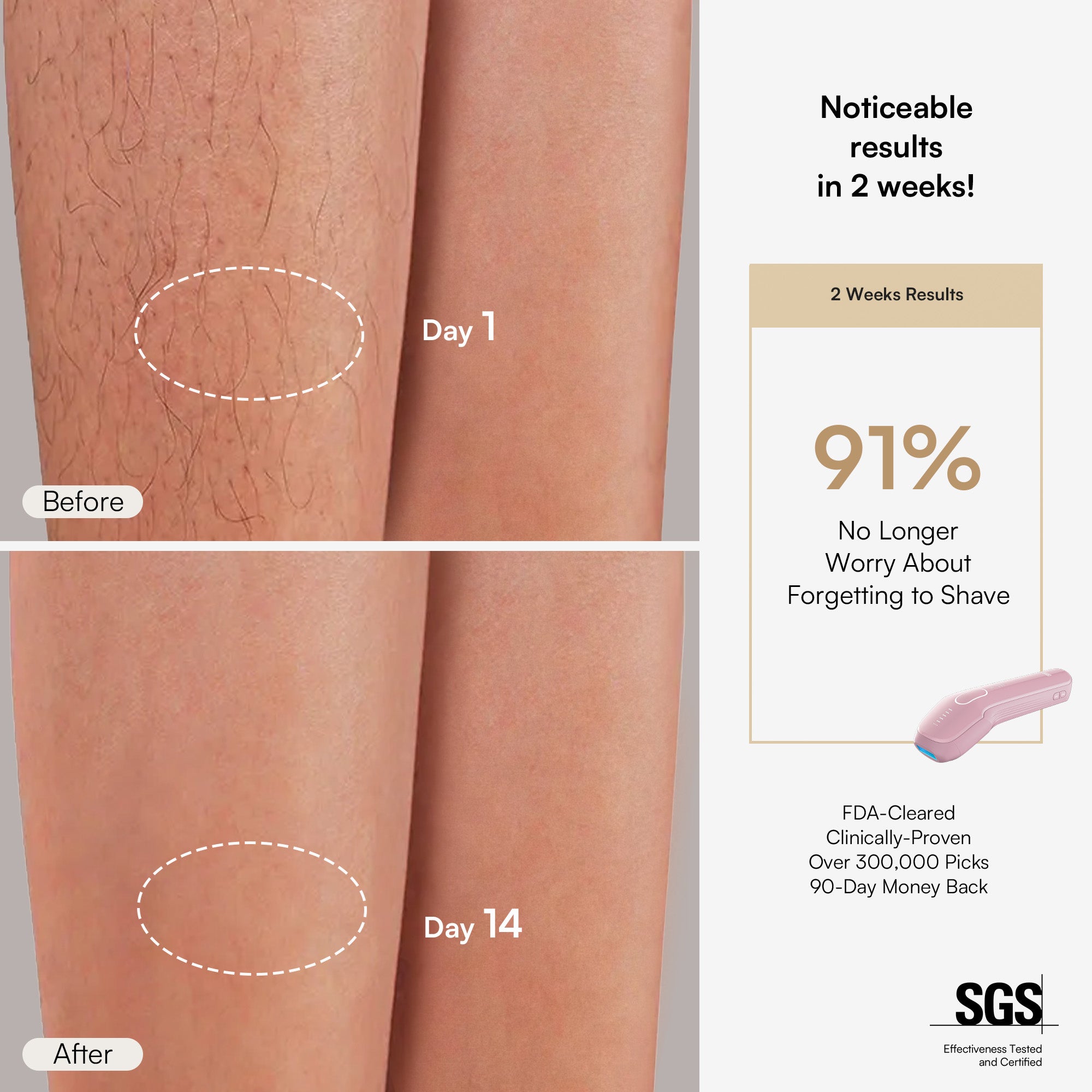 INIA HAUTE Pro IPL Hair Removal Device