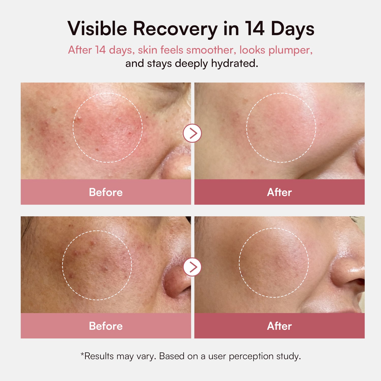 INIA PDRN + Peptide Repair Cream