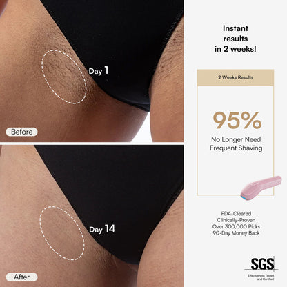 INIA HAUTE Pro IPL Hair Removal Device