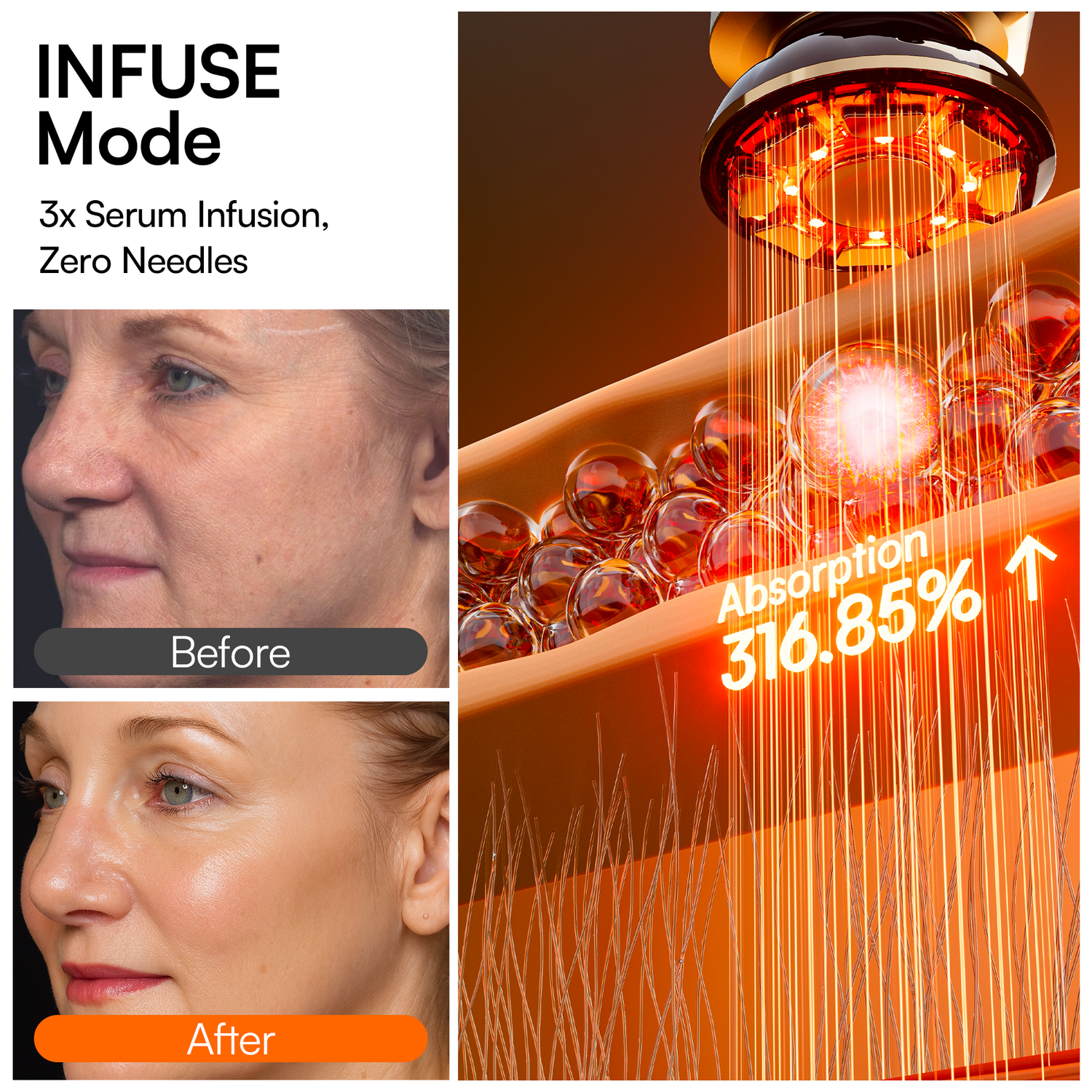 INIA FLARE Microcurrent Facial Device