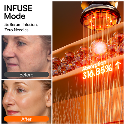 INIA FLARE Microcurrent Facial Device