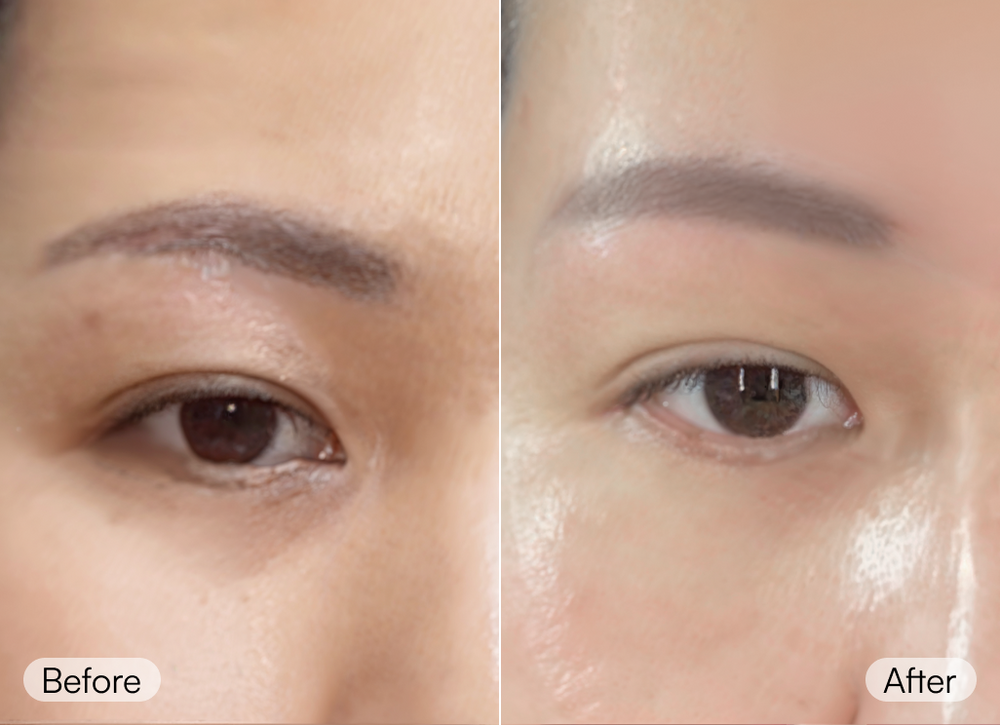 compare_image
