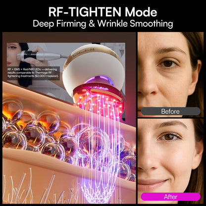 INIA SPHERA At-Home Clinical-Grade RF, EMS &amp; LED Rejuvenation Device