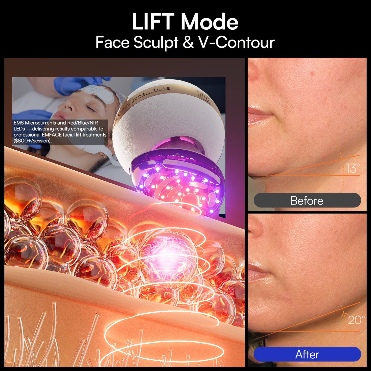 INIA SPHERA At-Home Clinical-Grade RF, EMS &amp; LED Rejuvenation Device
