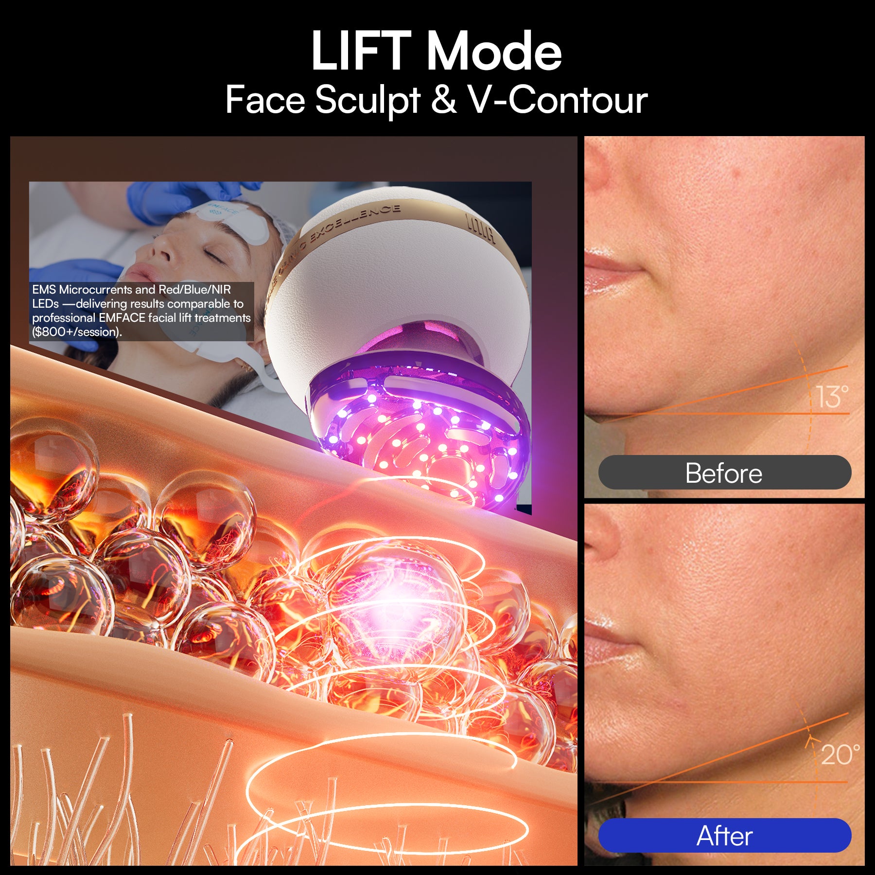 INIA SPHERA At-Home Clinical-Grade RF, EMS &amp; LED Rejuvenation Device