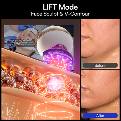 INIA SPHERA At-Home Clinical-Grade RF, EMS &amp; LED Rejuvenation Device