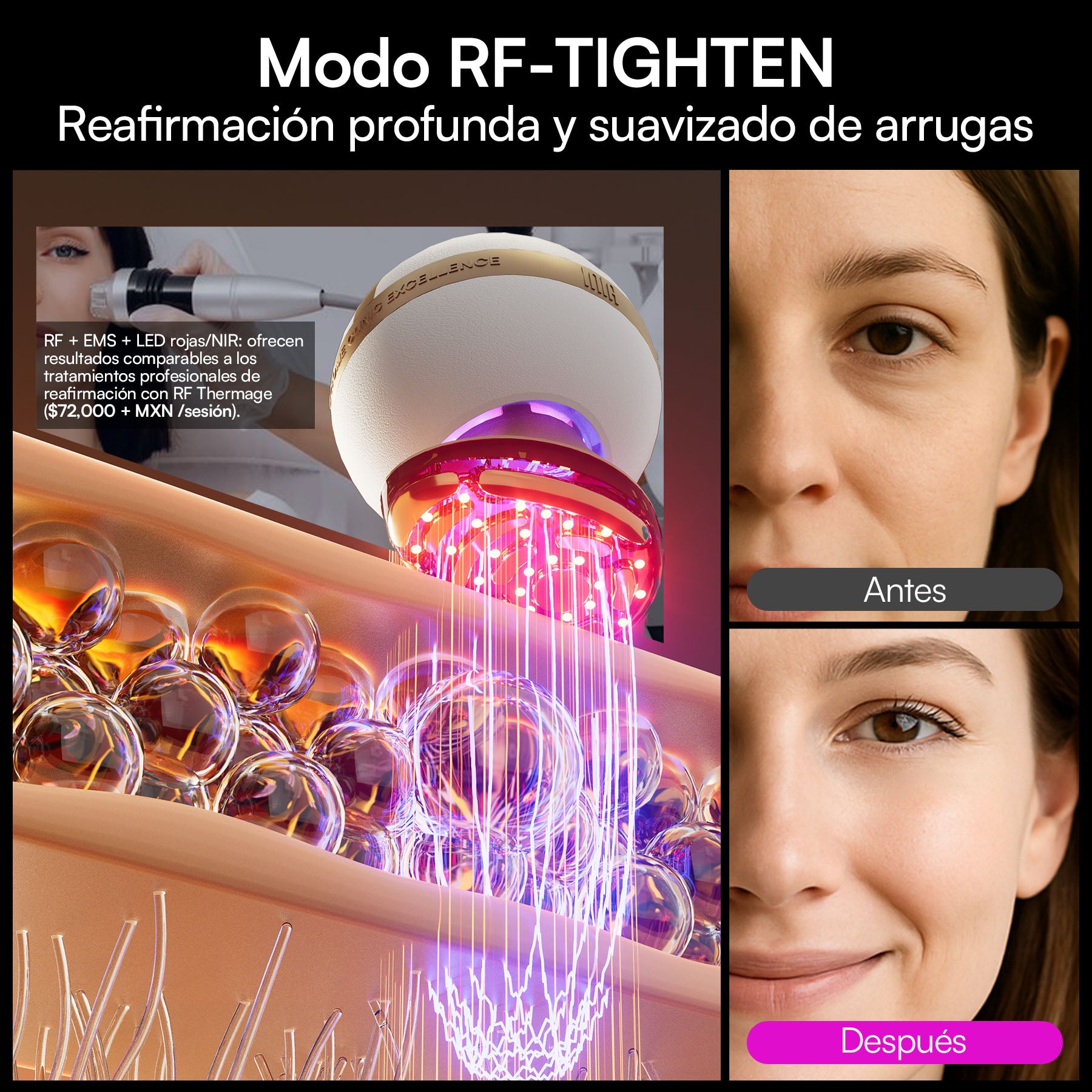 INIA SPHERA Dispositivo de rejuvenecimiento con RF, EMS y LED de grado clínico para uso en casa