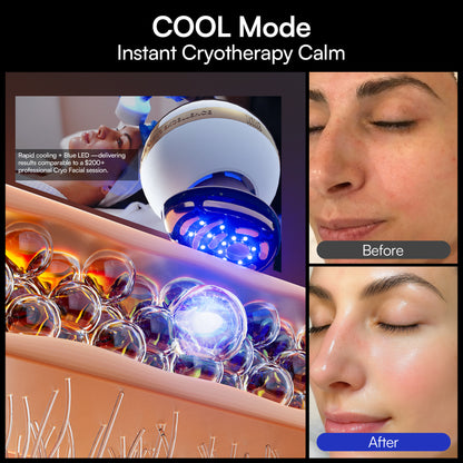 INIA SPHERA At-Home Clinical-Grade RF, EMS &amp; LED Rejuvenation Device