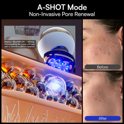 INIA SPHERA At-Home Clinical-Grade RF, EMS &amp; LED Rejuvenation Device