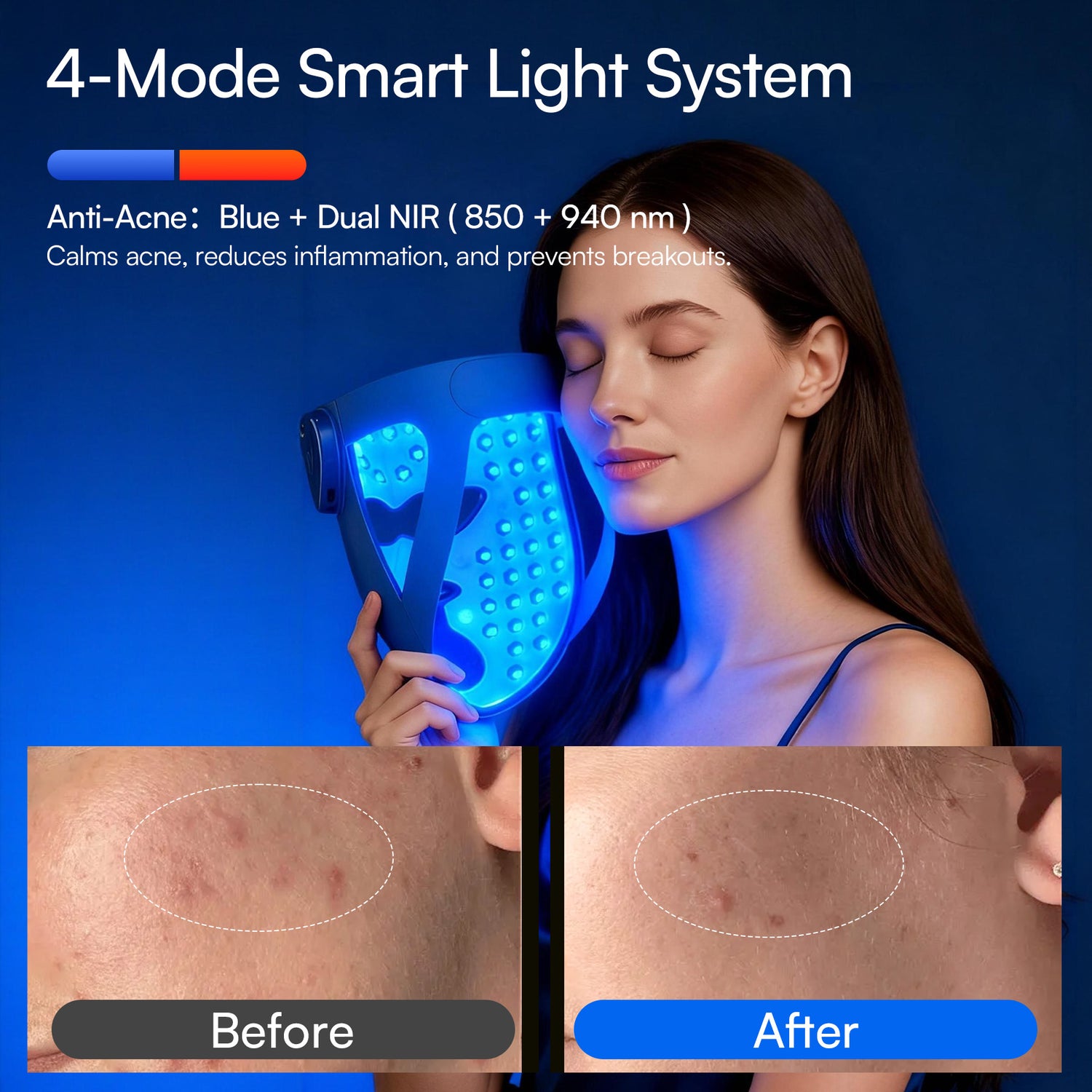 INIA GLOW 4D 940nm Dual NIR Wireless LED Mask