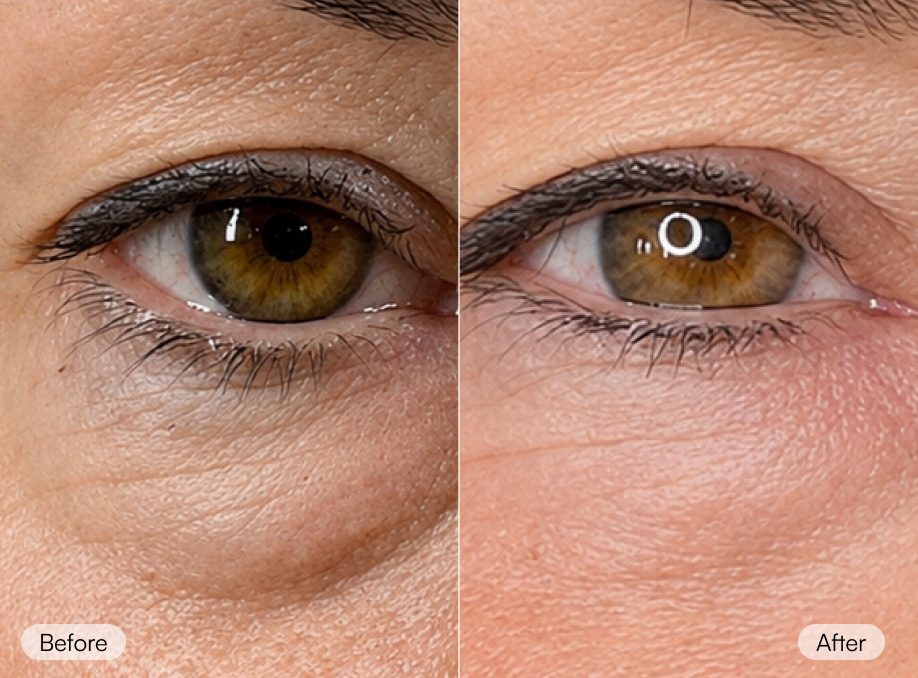 compare_image