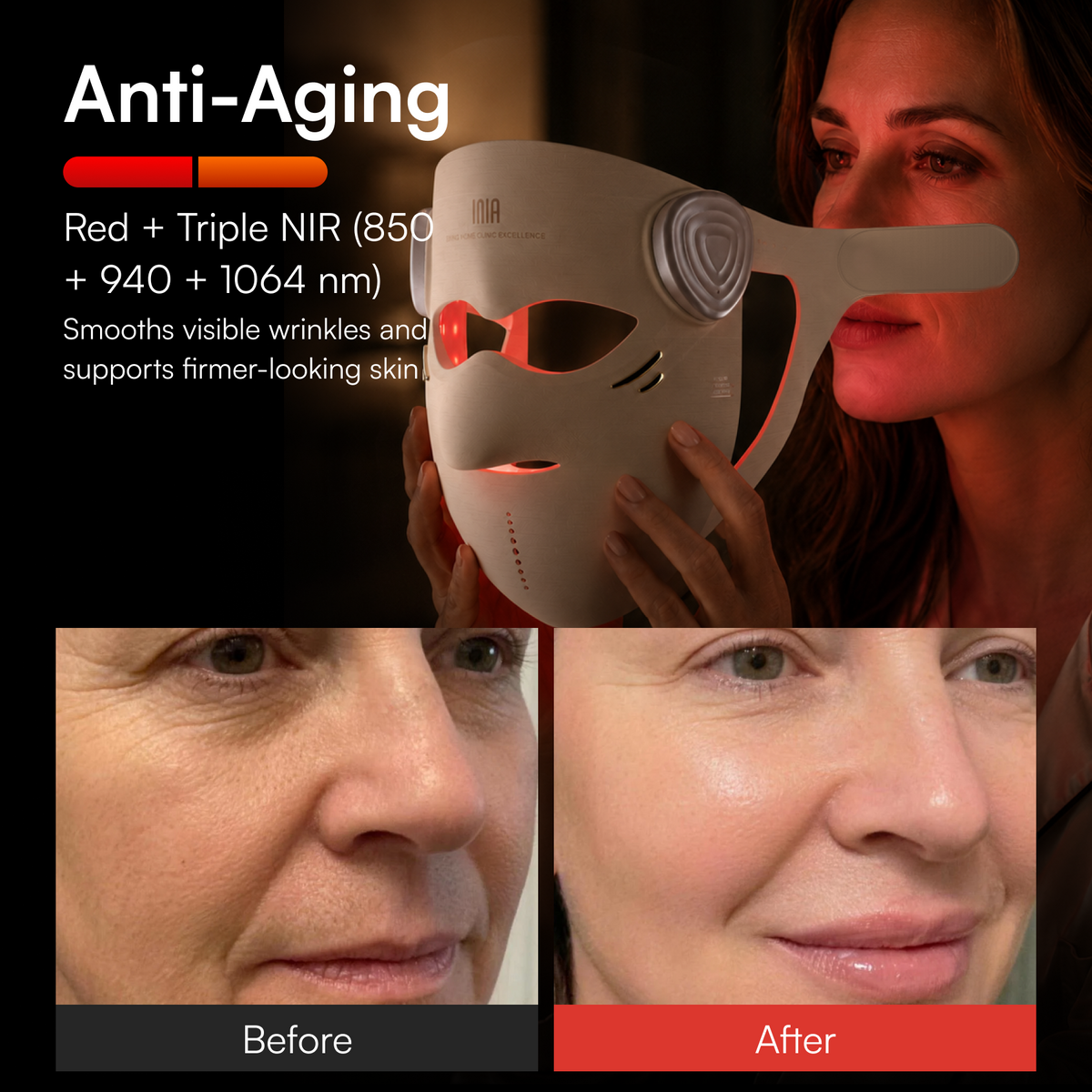 INIA GLOW 4D 1064nm LaserFusion™ Wireless Laser Mask