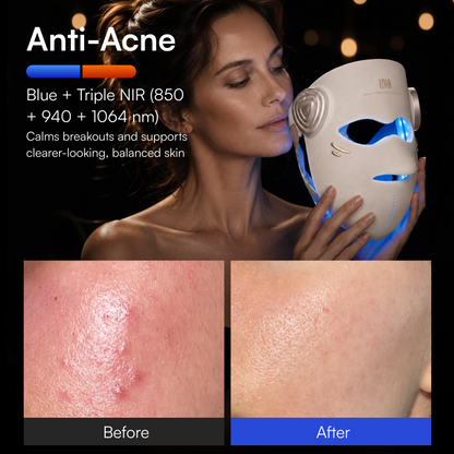 INIA GLOW 4D 1064nm LaserFusion™ Wireless Laser Mask