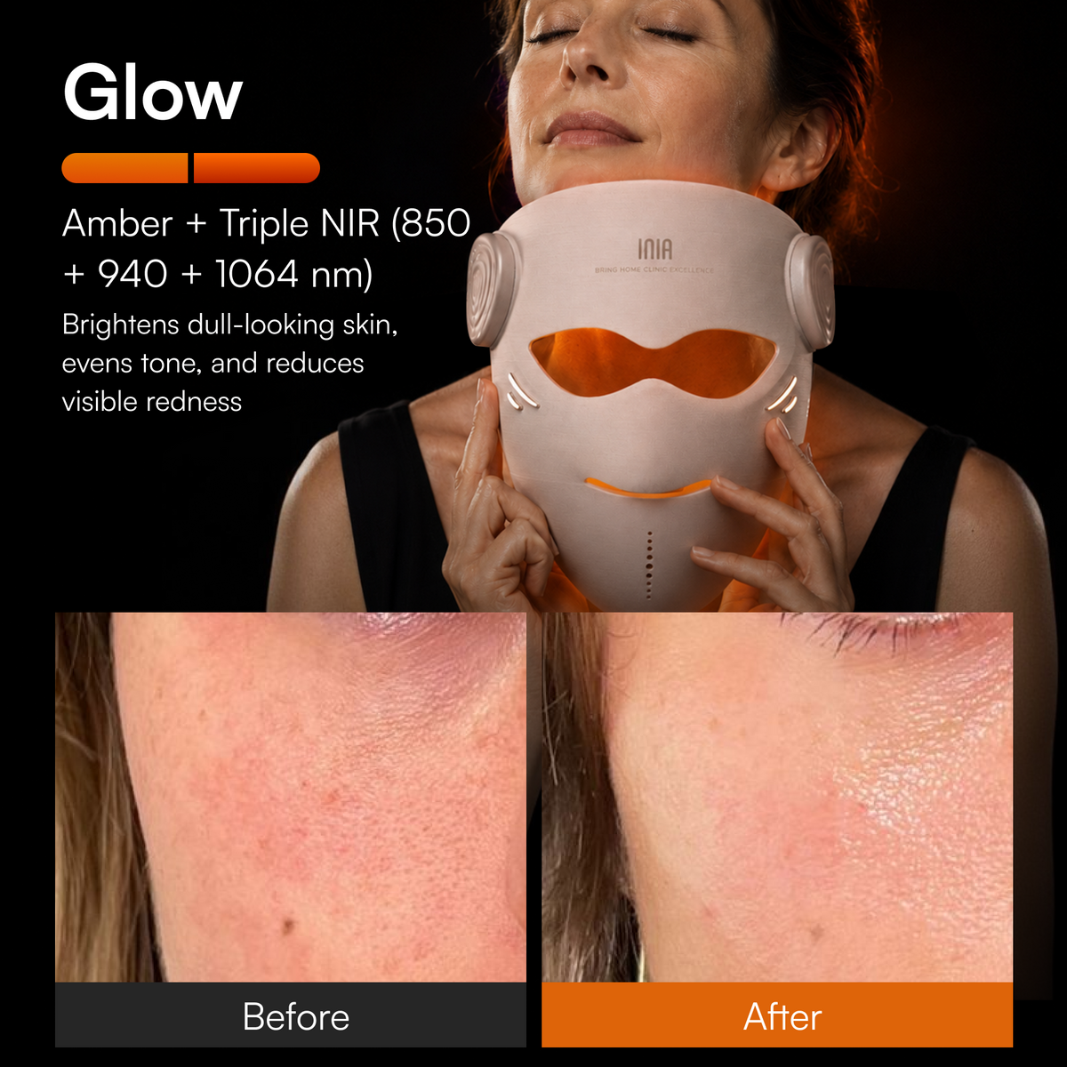 INIA GLOW 4D 1064nm LaserFusion™ Wireless Laser Mask