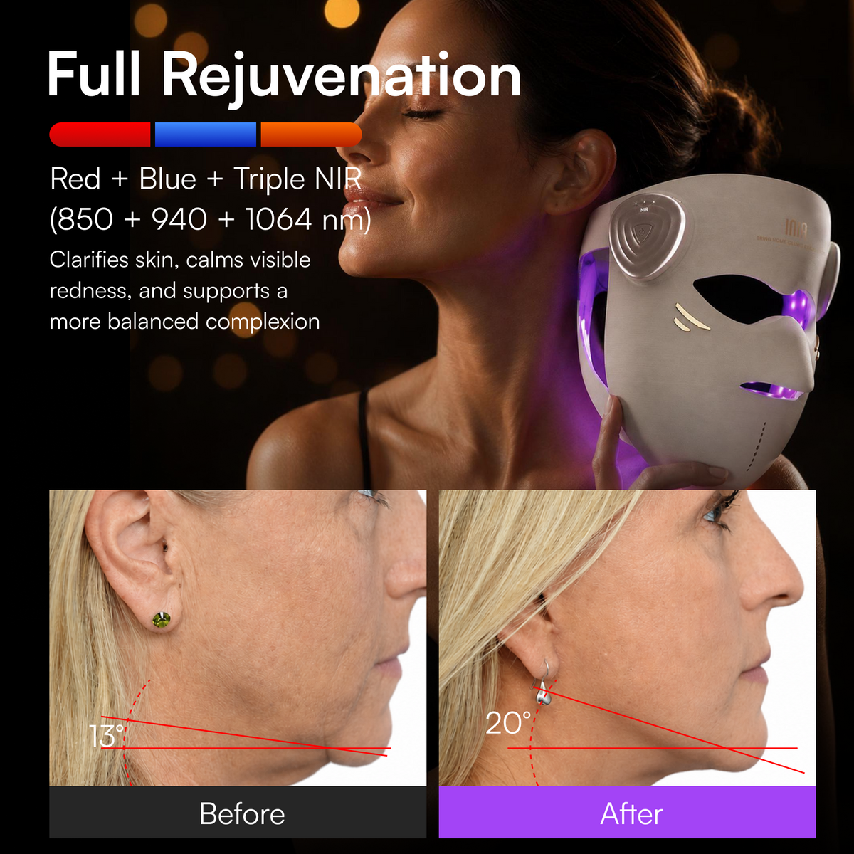 INIA GLOW 4D 1064nm LaserFusion™ Wireless Laser Mask