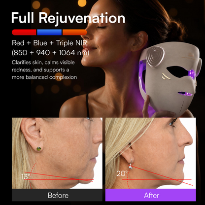 INIA GLOW 4D 1064nm LaserFusion™ Wireless Laser Mask